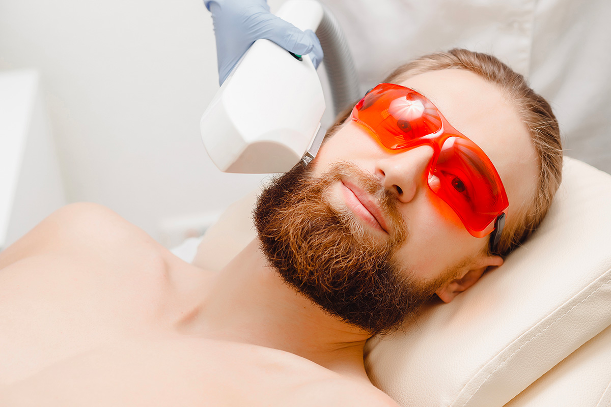 Epilation laser définitive de la barbe ou moustache en toute sécurité